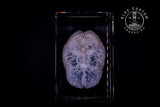 3D engraved anatomical brain crystal, alternate angle