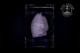 Anatomical lungs crystal engraving, alternate angle