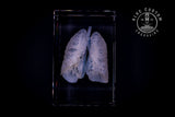 3D crystal anatomical lungs engraved inside a clear crystal block